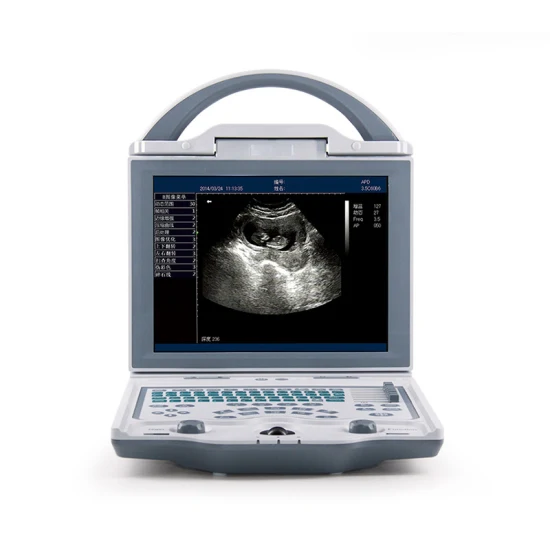 Mulheres pré-natal uso doméstico detector de ultrassom digital portátil doppler fetal monitor de freqüência cardíaca do bebê